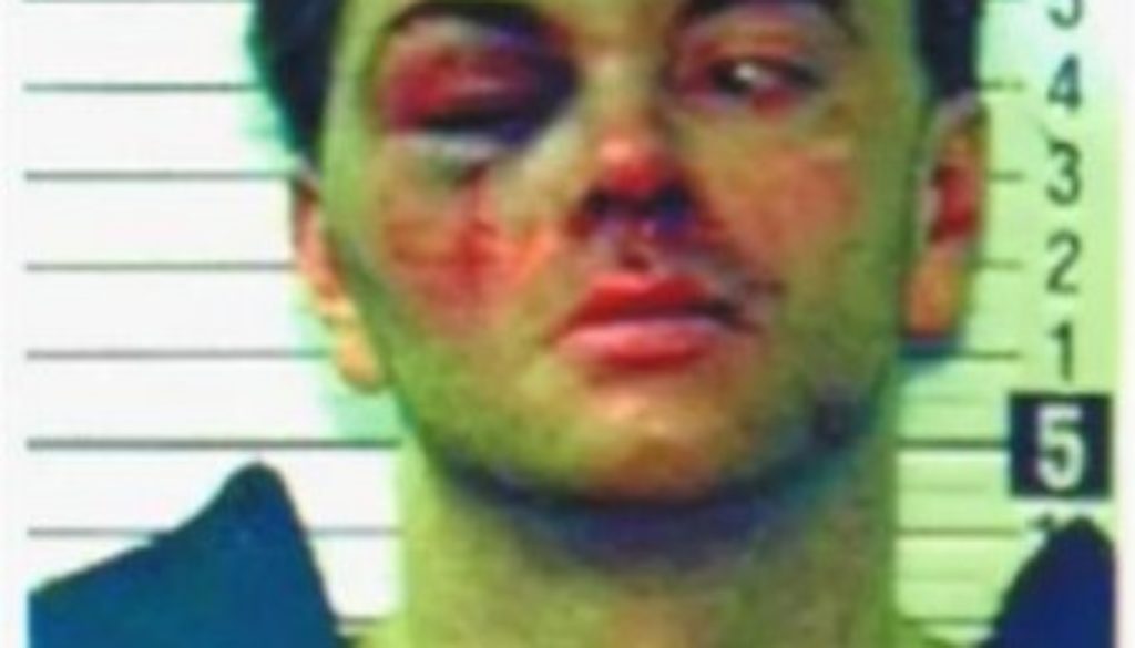 Robert Leone - victim of police brutality
