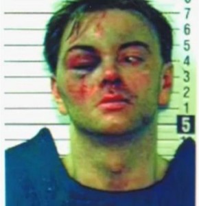 Robert Leone - victim of police brutality Robert Leone - victim of police brutality